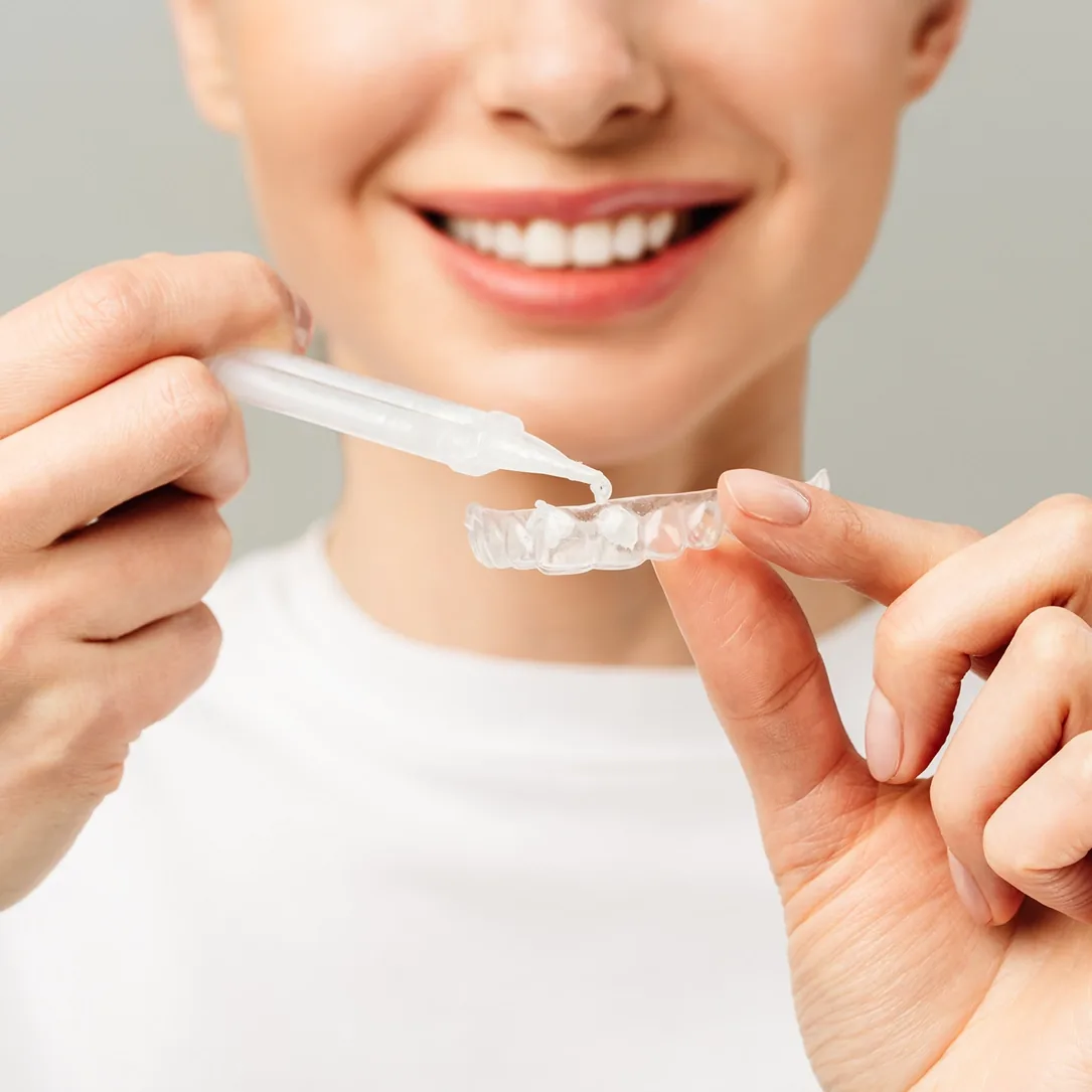 professional teeth whitening