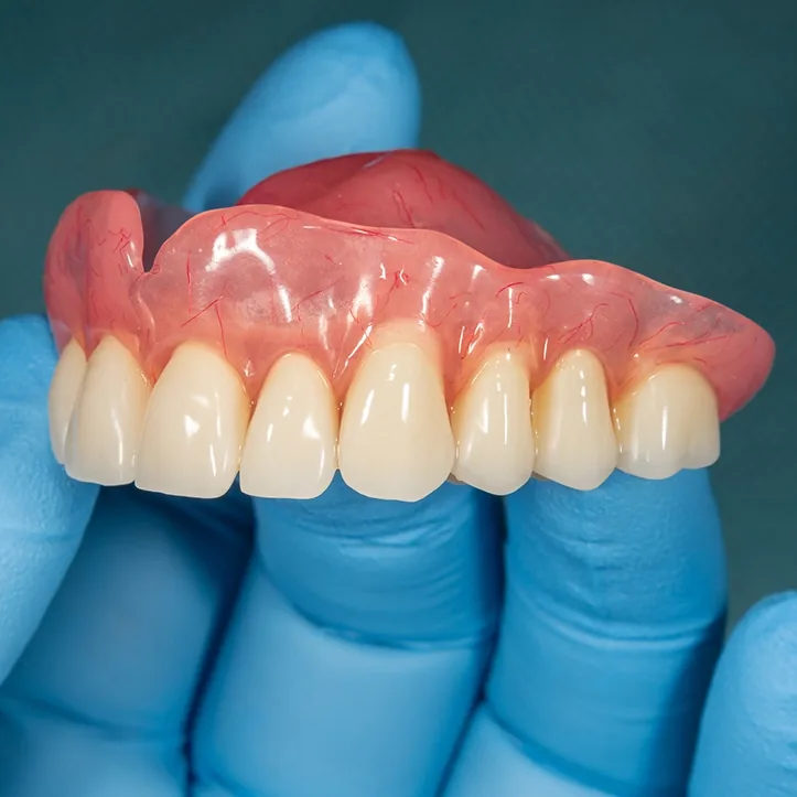immediate dentures
