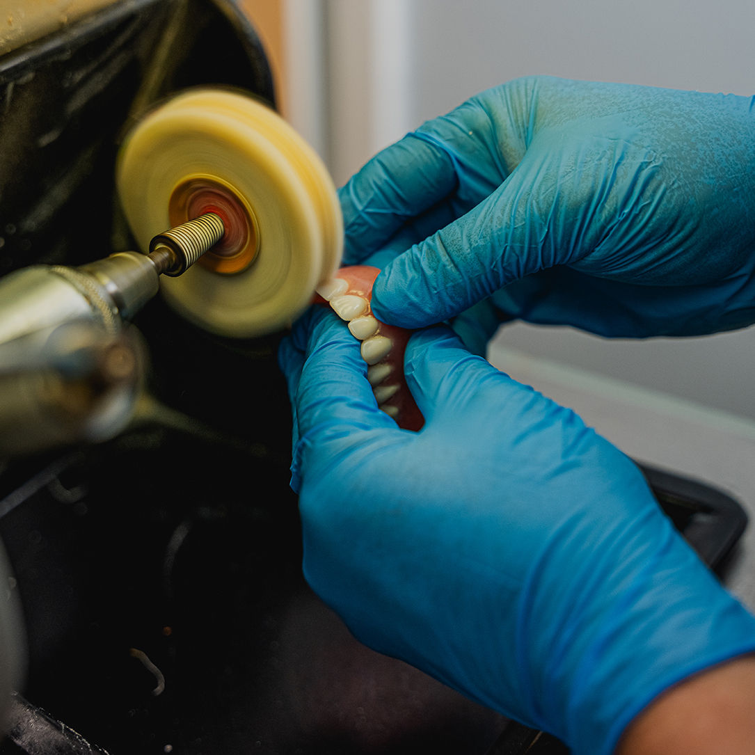 Dentures relines, additions and repairs