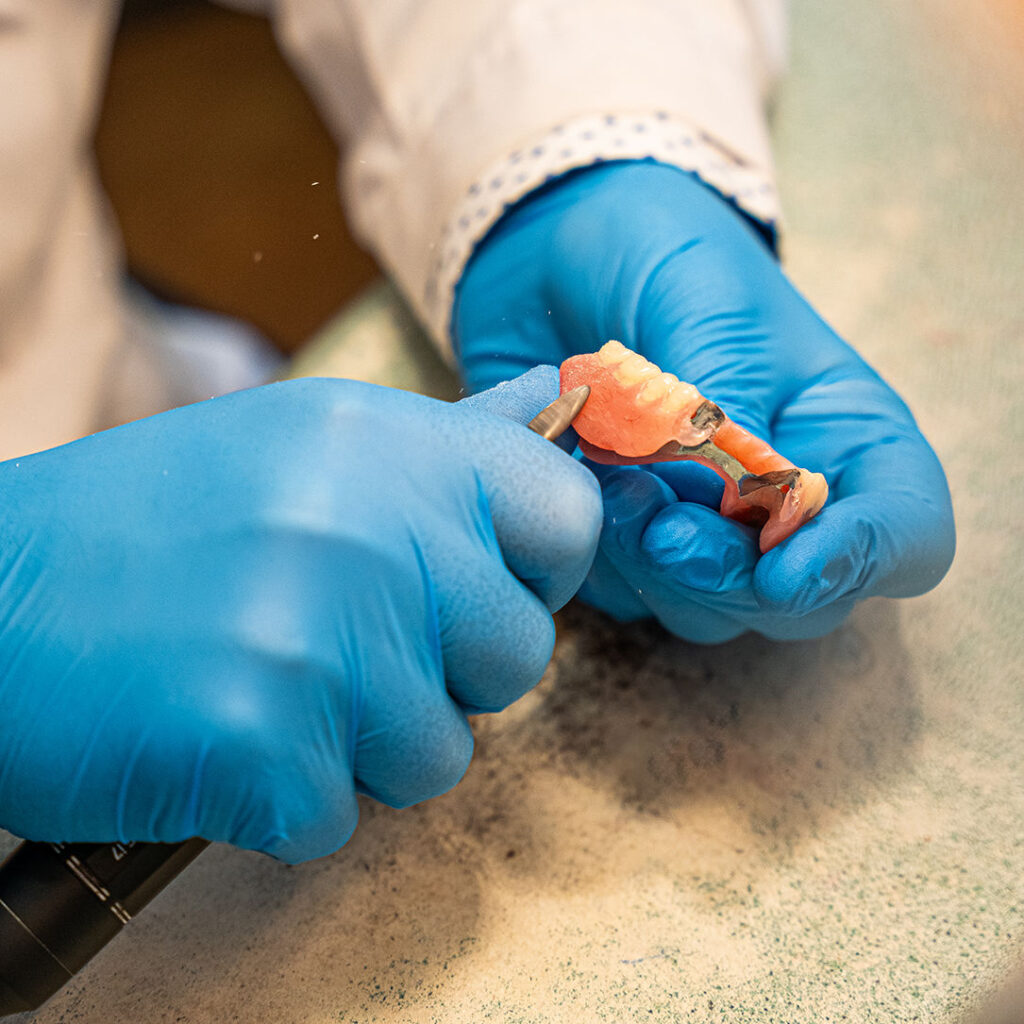 Partial Dentures