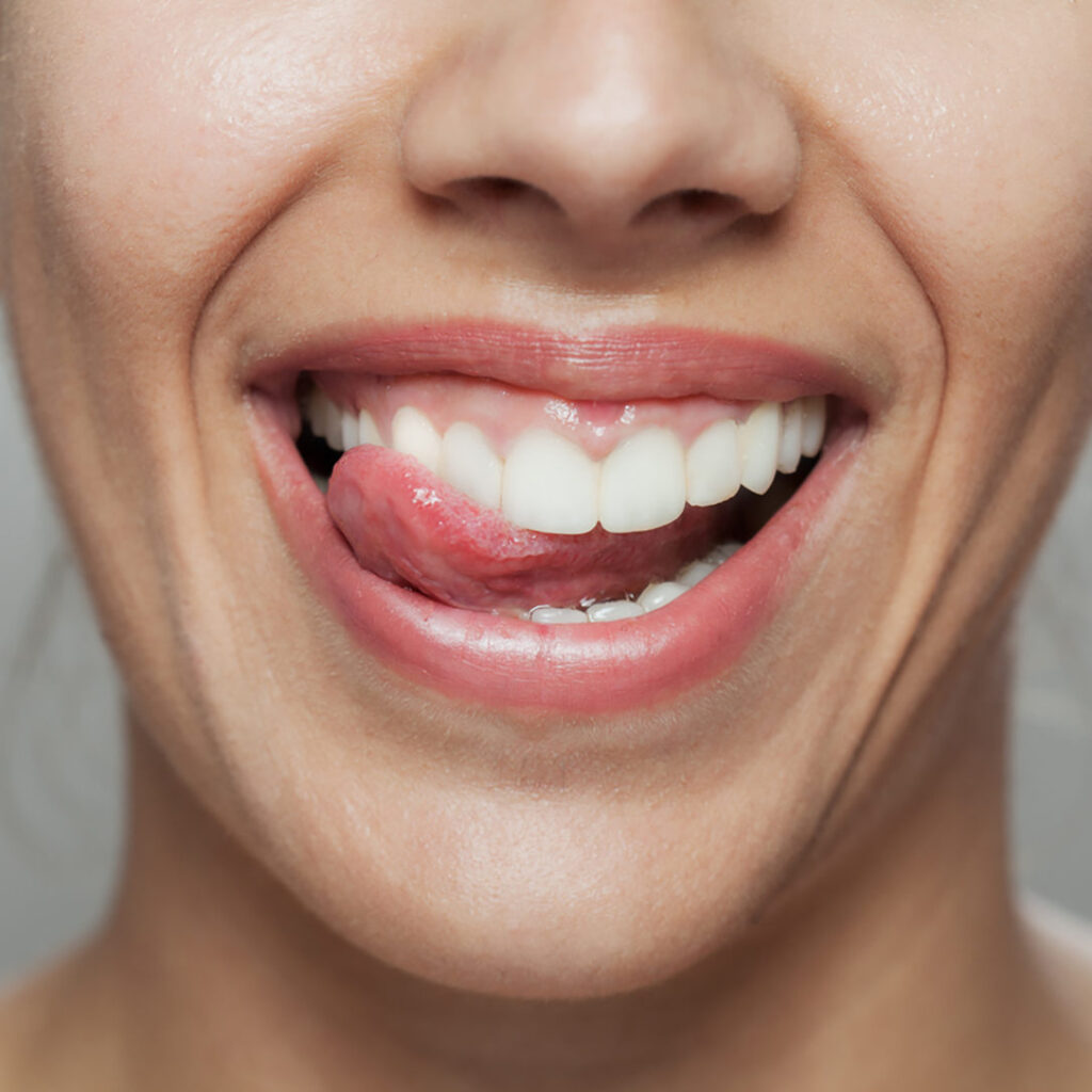 Teeth whitening