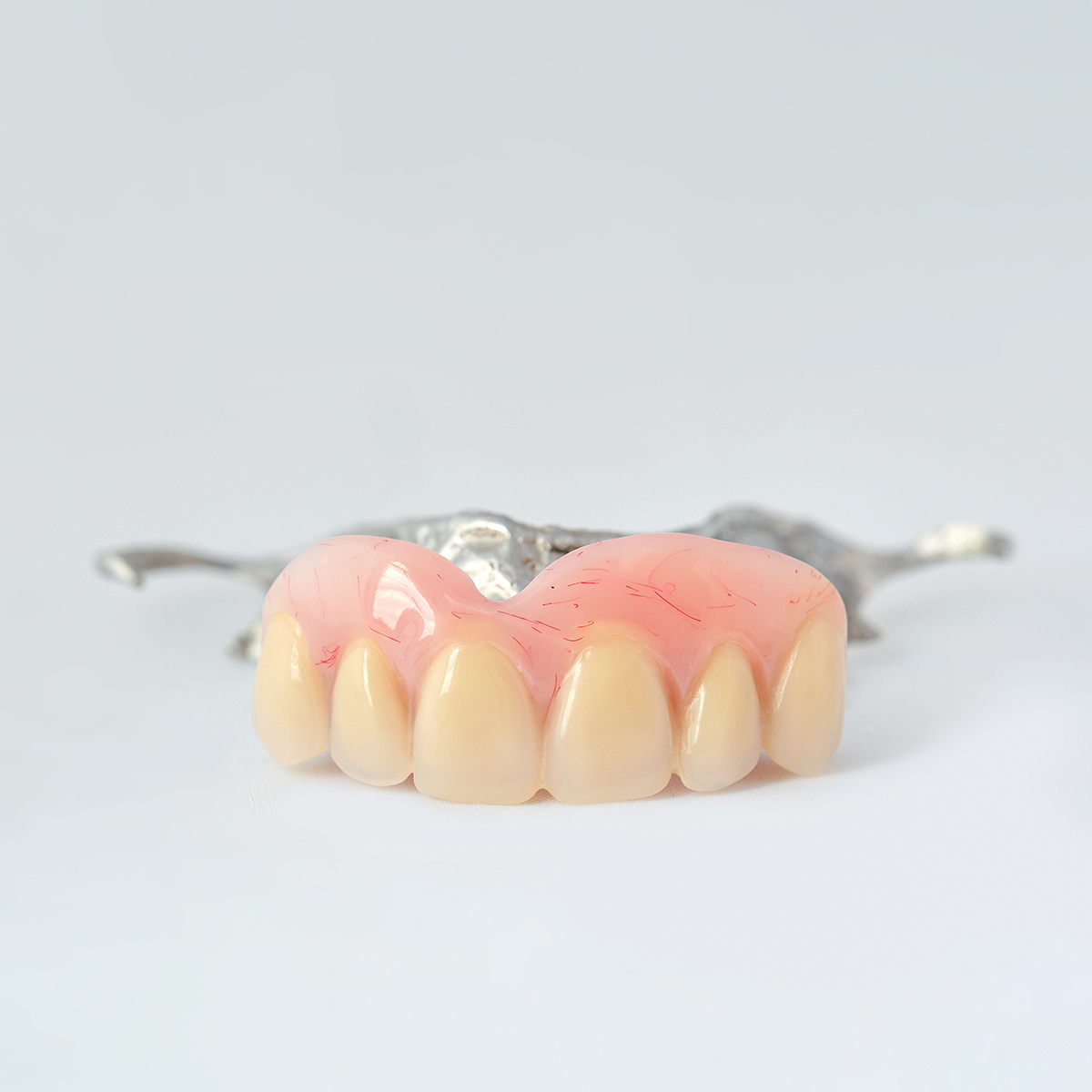 Partial Dentures