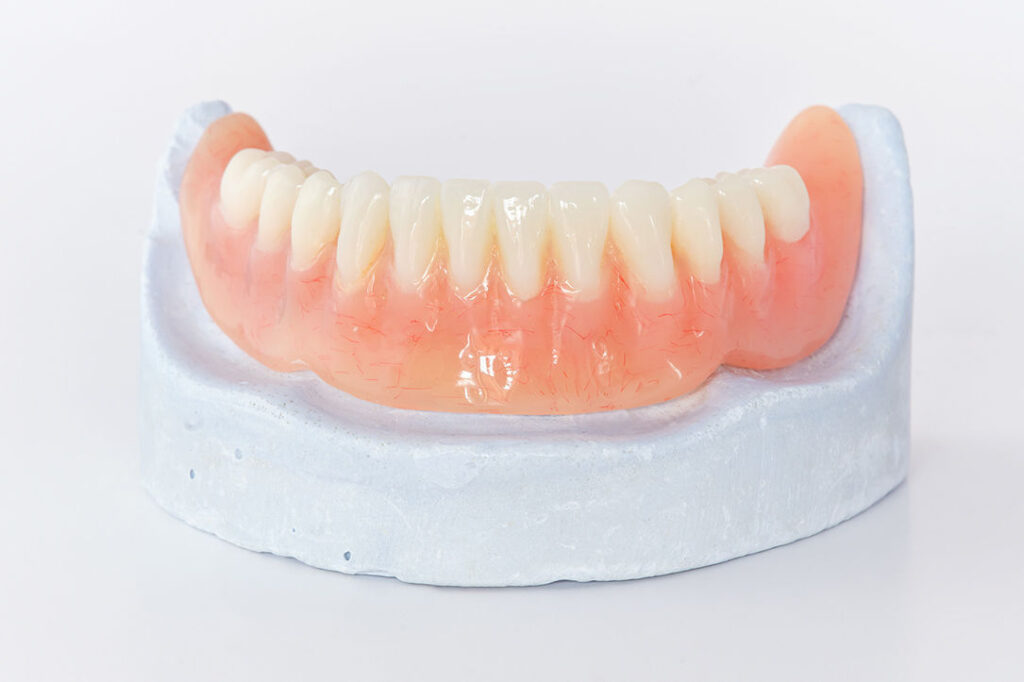 Implant Secured Dentures Hamilton ON